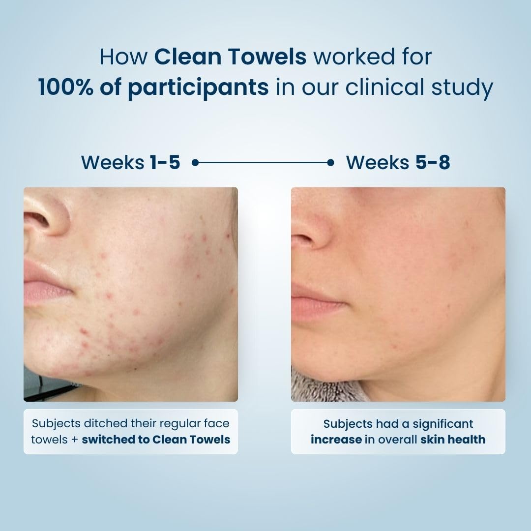 Clean Skin Club Clean Towels XL™, 100% USDA Biobased Face Towel, Disposable Face Towelette, Eczema Association Accepted, Makeup Remover Dry Wipes, Ultra Soft, 100 Ct, 2 Pack