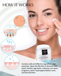 Dark Spot Remover for Face and Body: Hyperpigmentation Treatment - Natural Ingredient - Freckle/Melasma/Sun Spot/Age Spot Remover - Dark Spot Corrector Cream for Women and Men