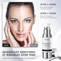 Super Vitamin C Face Serum for Mature Skin: All-in-One Hydrating Anti-Aging Formula by Vitamin C, Hyaluronic Acid, Caffeine-Firming, Lifting, Targets Dark Spots, Wrinkles, 1 fl oz (Pack of 1)