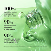 Anua Azelaic Acid 10 Hyaluron Redness Soothing Serum, Facial Serum for Sensitive skin, Hyaluronic Acid, Niacinamide, Spot Care, Natural Color, Vegan, Korean Skincare (30ml/ 1.01 fl oz.)