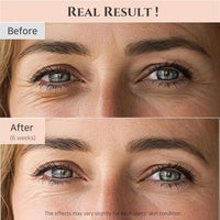 Joseon Revive Eye Serum with Retinal & Niacinamide for Puffy Eyes, Wrinkles, Dark Circles - Cart Shape
